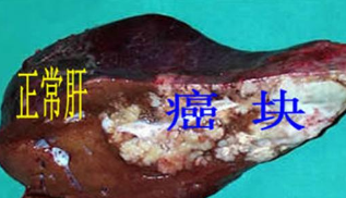 水污染與癌癥高發區必備這款儀器